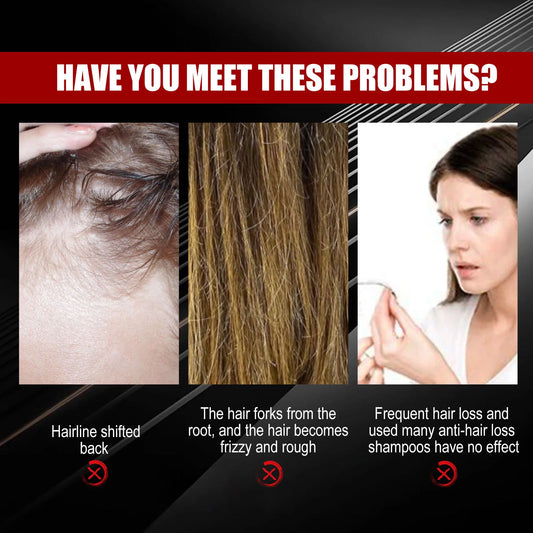 BLACK RICE HAIR MIST for STRENGTHENING & THICKENING MOISTURIZING & REPAIRING ROOTS SMOOTHING GROWTH SPRAY