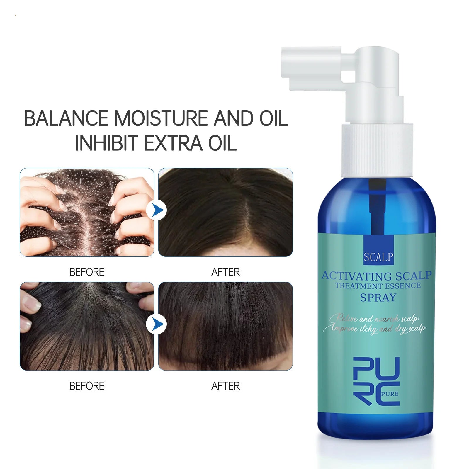 Hair Revitalizing Spray for Scalp Nourishment and Renewal